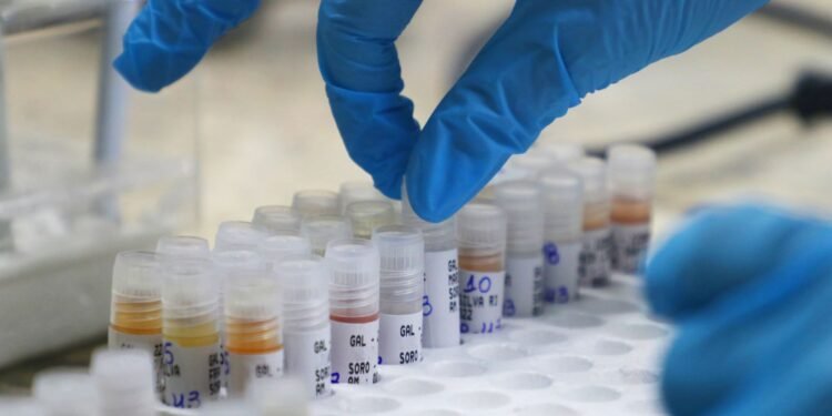 FVS divulga quadro semanal da MPOX no Amazonas nesta terça-feira, 25