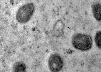 Varíola dos macacos