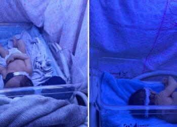 Denúncia: maternidade de Manaus não tem máquina adequada para tratar recém-nascido com icterícia