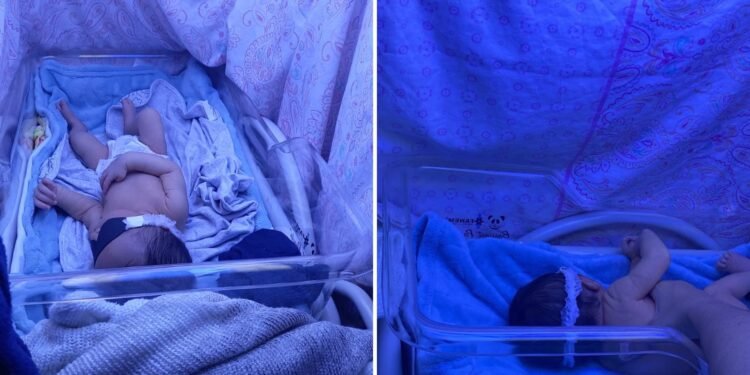 Denúncia: maternidade de Manaus não tem máquina adequada para tratar recém-nascido com icterícia