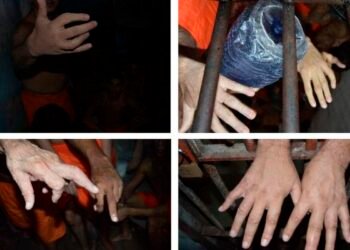 Dedos quebrados tortura presídios