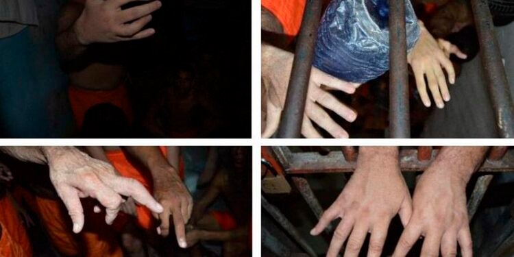 Dedos quebrados tortura presídios