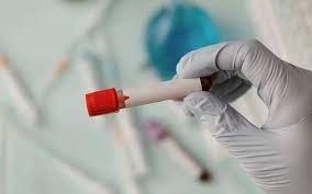 Chega ao Brasil primeiro exame de sangue que detecta a doença Alzheimer