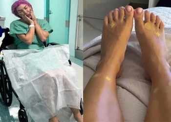 lorena-Lore Improta comenta problema nos pés após cirurgia e diz que precisa parar de dançar com salto