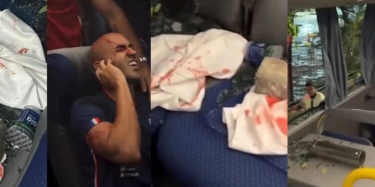 Jogadores do Fortaleza são hospitalizados após ataque a ônibus na saída da Arena Pernambuco