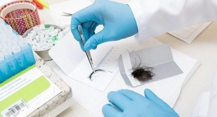 Exame Toxicológico - (Foto: Reprodução)