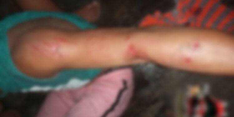 jacare-ataca-jovem