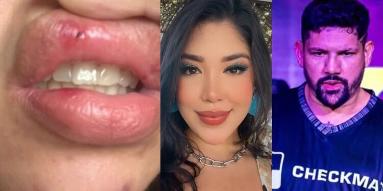 A cantora deixou um recado para as mulheres vítimas de violência doméstica - (Foto: Reprodução)