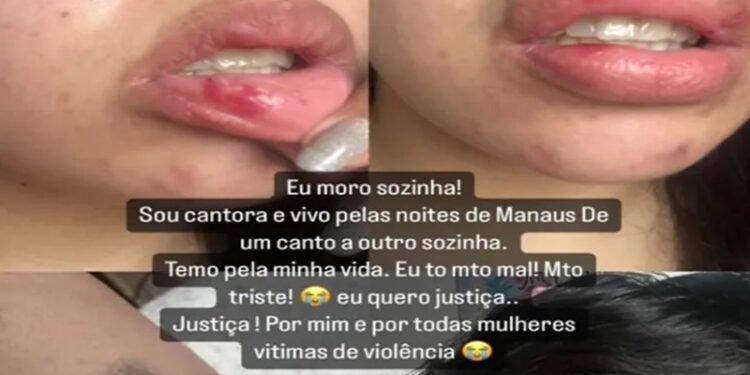 Servidor Público tenta matar namorada com faca, no Alvorada