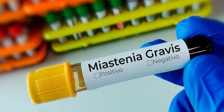 Marcadores sorológicos para miastenia gravis