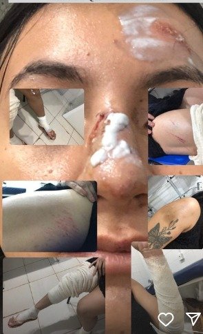 Registros das agressões - (Foto: Arquivo pessoal)