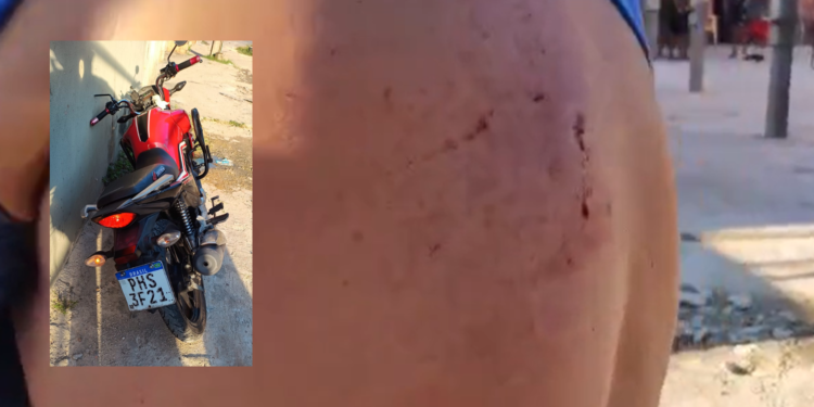 Criminosos invadem casa e torturam vítima