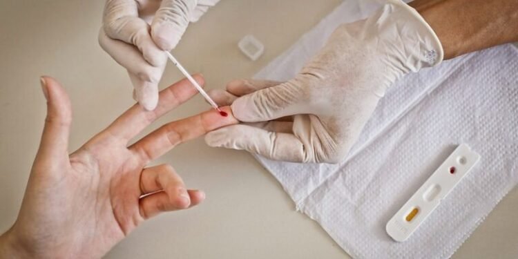 teste-rapido-hiv-sifilis