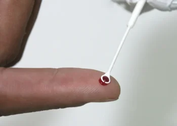 . A orientação consta em nota técnica publicada nesta quarta-feira (3) pelo Ministério da Saúde.