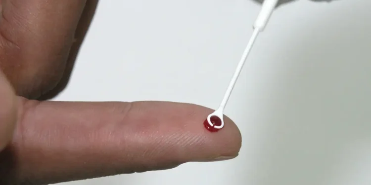 . A orientação consta em nota técnica publicada nesta quarta-feira (3) pelo Ministério da Saúde.