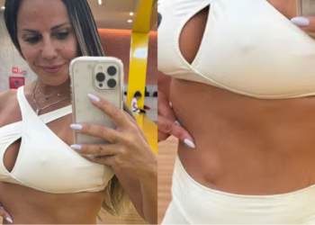 Viviane Araújo é operada para retirar hérnia umbilical