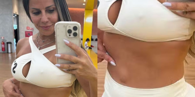 Viviane Araújo é operada para retirar hérnia umbilical