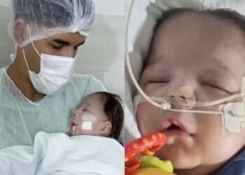 zevaqueiro-sindromepatau