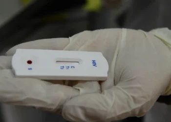 Saúde orienta farmácias sobre testes para HIV, sífilis e hepatites