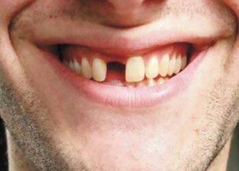Perda dos dentes afeta mais de 36 milhões de brasileiros
