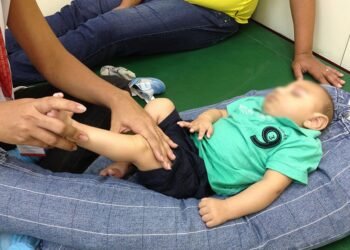 Mais de 3 mil crianças nasceram com microcefalia entre 2015 e 2018, segundo o Ministério da Cidadania Sumaia Villela/Agência Brasil Fonte: Agência Senado