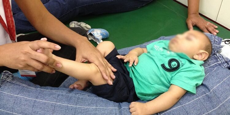 Mais de 3 mil crianças nasceram com microcefalia entre 2015 e 2018, segundo o Ministério da Cidadania Sumaia Villela/Agência Brasil Fonte: Agência Senado