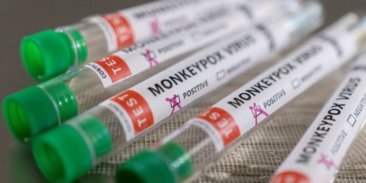 Com 709 casos de mpox no Brasil, ministério convoca reunião