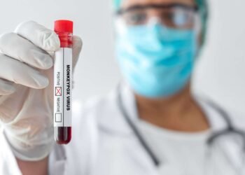 A FVS registrou 9 casos suspeitos da doença (Foto: Reprodução)