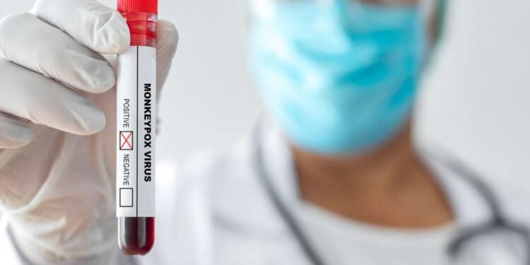 A FVS registrou 9 casos suspeitos da doença (Foto: Reprodução)