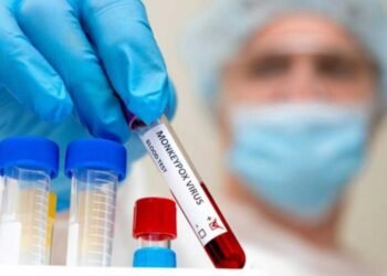 Amazonas registra três casos de varíola do macaco (Mpox)