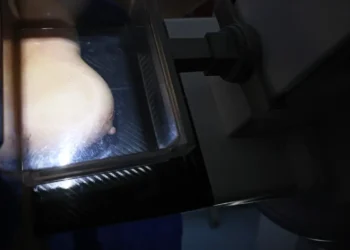 Médicos reafirmam eficácia da mamografia para prevenir câncer de mama