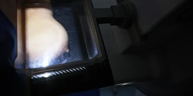 Médicos reafirmam eficácia da mamografia para prevenir câncer de mama