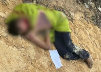 Homem tem a pele do rosto arrancada no ramal do Brasileirinho