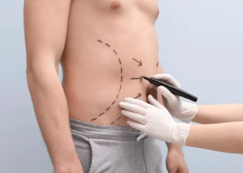 Médicos alertam sobre riscos de lipoaspiração fora de hospital