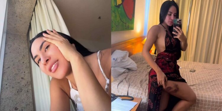 Isabelle Nogueira mostra 'roxo' nas coxas (Reprodução/Instagram)