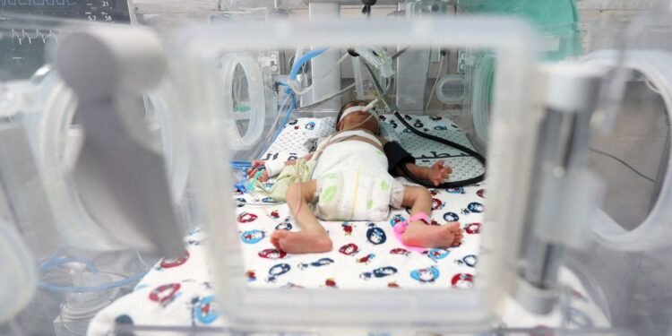 Taxa de nascimentos prematuros do Brasil está acima da média global