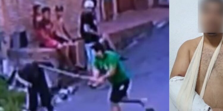 Homem é agredido e tem braço quebrado após golpear pessoa em situação de rua (Fotos: Reprodução/ redes sociais)