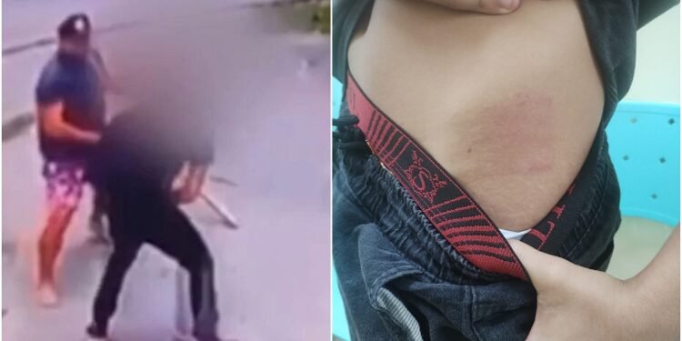 Adolescente autista agredido por motorista e a avó prestam depoimento no 18º DIP