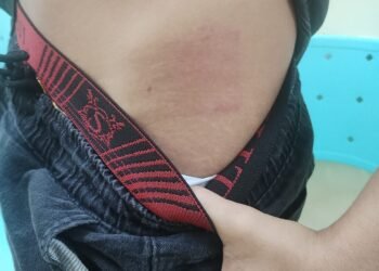 adolescente-autista-agredido