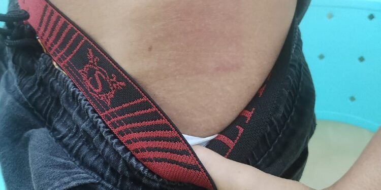 adolescente-autista-agredido