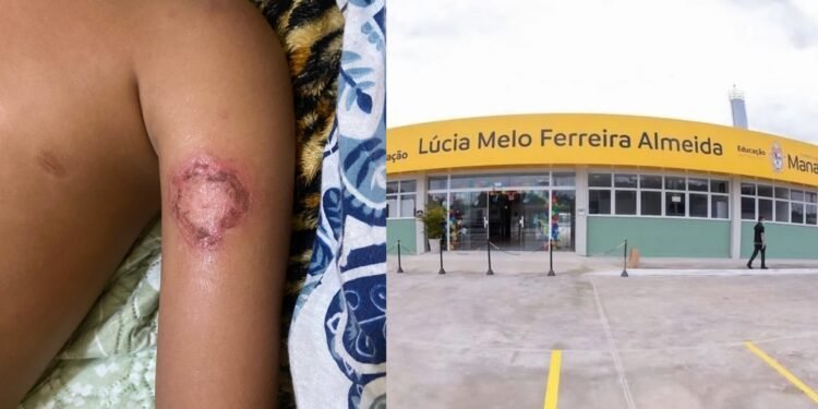 Mãe entra na Justiça contra a Prefeitura de Manaus após filho autista ser ferido em escola municipal