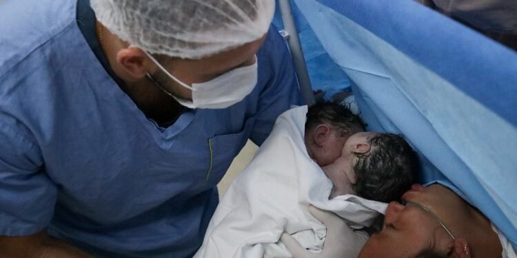 Bebês siamesas nos braços do médico (Foto: Arthur Castro/Secom)