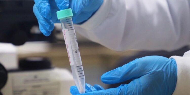 Sobe para 24 os casos confirmados de mpox em Manaus