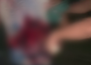 Vídeo homem caminha com faca nas costas no interior do Amazonas