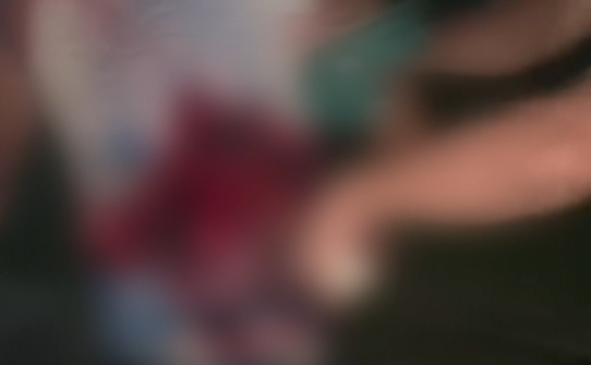 Vídeo homem caminha com faca nas costas no interior do Amazonas