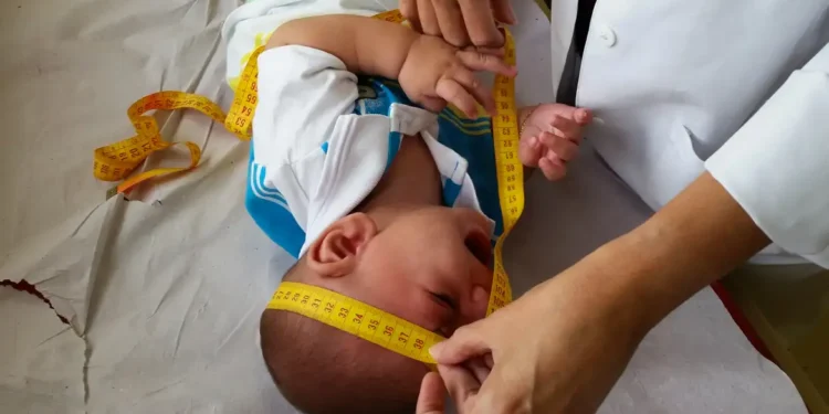 INSS pagará indenização de R$ 60 mil a crianças vítimas de zika