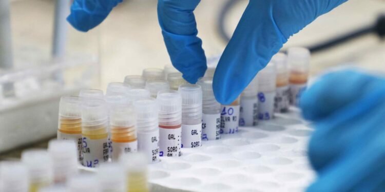 Manaus continua com 36 casos de mpox confirmados diz FVS-AM