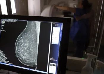 Câncer de mama: uma em cada três pacientes tem menos de 50 anos