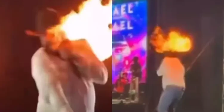 cantor-show-queima-rosto