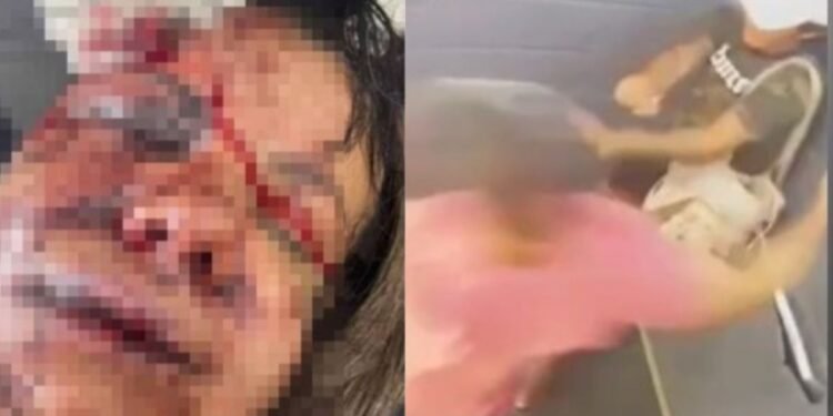 mulher-espancada-elevador